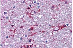 Immunohistochemistry (Formalin-fixed Paraffin-embedded Sections) (IHC (fp)) image for anti-Amyloid beta (A4) Precursor Protein (APP) (AA 737-751) antibody (ABIN790494)