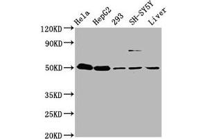 Western Blot Positive WB detected in: Hela whole cell lysate, HepG2 whole cell lysate, 293 whole cell lysate, SH-SY5Y whole cell lysate, Mouse liver tissue All lanes: DYM antibody at 3.