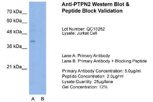 Host:  Rabbit  Target Name:  PTPN2  Sample Type:  Jurkat  Lane A:  Primary Antibody  Lane B:  Primary Antibody + Blocking Peptide  Primary Antibody Concentration:  5. (PTPN2 Antikörper  (N-Term))
