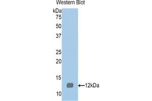 Western blot analysis of the recombinant protein. (S100 Protein (S100) (AA 2-94) Antikörper)