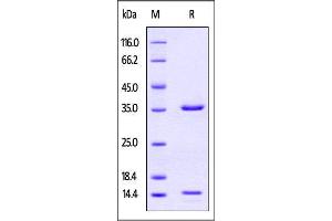 SDS-PAGE (SDS) image for neonatal Fc Receptor (FcRn) (AA 16-289) protein (His tag,Strep Tag) (ABIN4949195)
