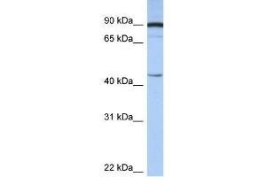 Human Brain; WB Suggested Anti-PSMD6 Antibody Titration: 0. (PSMD6 Antikörper  (N-Term))
