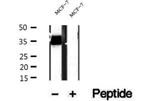 Western blot analysis of extracts of MCF-7 cells, using RQCD1 antibody. (RQCD1 Antikörper  (Internal Region))