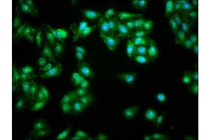 Immunofluorescence staining of HepG2 cells with ABIN7145619 at 1:166, counter-stained with DAPI. (FHIT Antikörper  (AA 2-147))