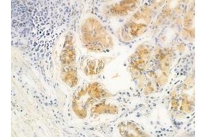 ABIN6261924 and ABIN6266907 at 1/100 staining human normal gastric tissue by IHC-P. (GUCY1B3 Antikörper  (N-Term))