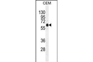 Western blot analysis in CEM cell line lysates (35ug/lane). (DOK3 Antikörper  (C-Term))