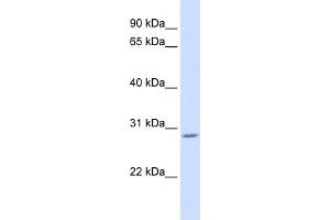 WB Suggested Anti-AEBP2 Antibody Titration: 0. (AEBP2 Antikörper  (C-Term))