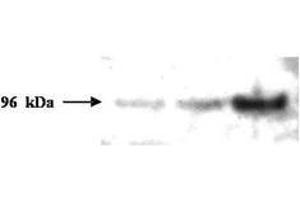 Image no. 1 for anti-PMS2 Postmeiotic Segregation Increased 2 (S. Cerevisiae) (PMS2) (AA 58-81) antibody (ABIN296611) (PMS2 Antikörper  (AA 58-81))