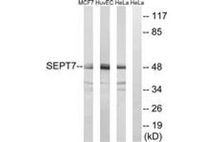 Western blot analysis of extracts from HeLa/HuvEc/MCF-7 cells, using SEPT7 Antibody.