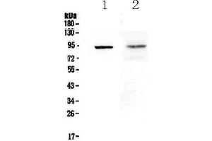 Western blot analysis of TLR1 using anti-TLR1 antibody .