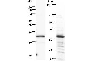 Left: PHF1 staining. (PHF1 Antikörper)