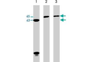 Western blot analysis of Jurkat (lane 1), A-431 (lane 2), and HeLa (lane 3) cell lysates (20 ug/lane). (Neural Wiskott-Aldrich syndrome protein (WASL) (C-Term) Antikörper)