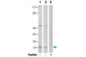 Western blot analysis of extracts from Jurkat cells (Lane 1) and COLO 205 cells (Lane 2 and lane 3), using PPP1R14C polyclonal antibody . (PPP1R14C Antikörper)