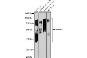 Western blot analysis of extracts of various cell lines, using IFNGR1 antibody  at 1:1000 dilution. (IFNGR1 Antikörper)