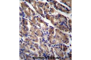 ABRA Antibody (C-term) immunohistochemistry analysis in formalin fixed and paraffin embedded human stomach tissue followed by peroxidase conjugation of the secondary antibody and DAB staining. (ABRA Antikörper  (C-Term))