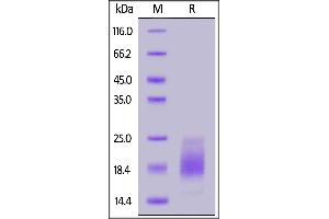 Human IL-15, His Tag on  under reducing (R) condition. (IL-15 Protein (AA 49-162) (His tag))