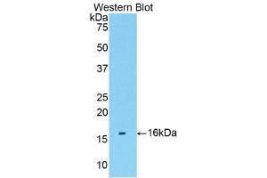 Western Blotting (WB) image for anti-Transmembrane Protein 27 (TMEM27) (AA 17-137) antibody (ABIN1176811)