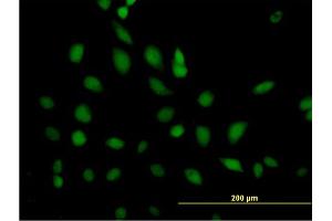 Immunofluorescence (IF) image for anti-Excision Repair Cross-Complementing Rodent Repair Deficiency, Complementation Group 2 (ERCC2) (AA 1-760) antibody (ABIN515382)