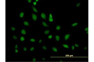 Immunofluorescence of purified MaxPab antibody to ERCC2 on HeLa cell. (ERCC2 Antikörper  (AA 1-760))