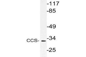 Western blot (WB) analysis of CCS antibody in extracts from Jurkat cells. (Superoxide dismutase copper chaperone Antikörper)