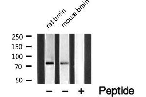 Western blot analysis of extracts of various samples,using MAN1B1 Antibody . (MAN1B1 Antikörper  (Internal Region))