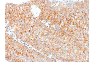 Immunohistochemistry (IHC) image for anti-SERPINE1 mRNA Binding Protein 1 (SERBP1) (AA 3-139) antibody (ABIN6939486)