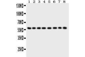 Western Blotting (WB) image for anti-Purinergic Receptor P2X, Ligand Gated Ion Channel 2 (P2RX2) (AA 139-471) antibody (ABIN3043588)