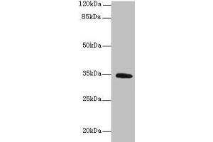 Western blot All lanes: SETD9 antibody at 6 μg/mL + K562 whole cell lysate Secondary Goat polyclonal to rabbit IgG at 1/10000 dilution Predicted band size: 35, 31 kDa Observed band size: 35 kDa (C5orf35 Antikörper  (AA 1-299))