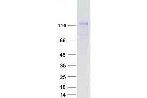 Validation with Western Blot