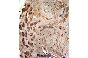 Immunohistochemistry (Paraffin-embedded Sections) (IHC (p)) image for anti-Protein Kinase, Interferon-Inducible Double Stranded RNA Dependent Activator (PRKRA) (AA 225-252) antibody (ABIN392151)