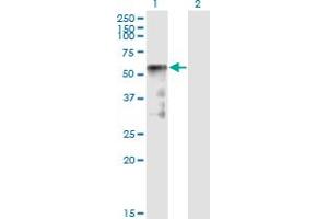Western Blot analysis of SESN2 expression in transfected 293T cell line by SESN2 monoclonal antibody (M01), clone 1A12. (Sestrin 2 Antikörper  (AA 1-480))
