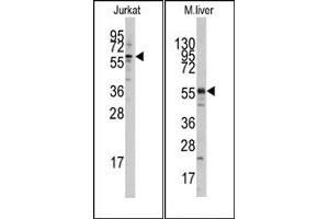 Image no. 1 for anti-K(lysine) Acetyltransferase 5 (KAT5) (N-Term) antibody (ABIN356624)