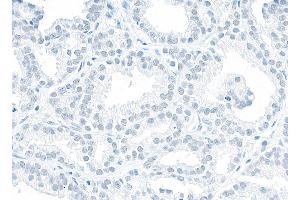 Immunohistochemistry (IHC) image for anti-Non-POU Domain Containing, Octamer-Binding (NONO) (AA 1-50) antibody (ABIN7453849) (NONO Antikörper  (AA 1-50))