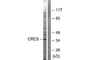Western blot analysis of extracts from Hela cells treated with PMA (125ng/ml, 30min), using CREB (Ab-142) antibody (#B0006, Line 1 and 2). (CREB1 Antikörper  (Ser142))