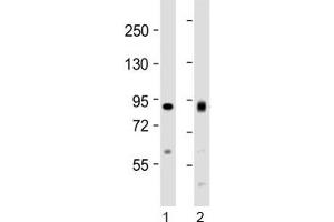 Western blot testing of human 1) HeLa and 2) Jurkat cell lysate with ACO2 antibody at 1:1000. (ACO2 Antikörper  (AA 294-325))