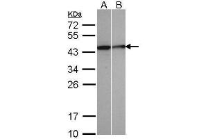 WB Image Sample(30 μg of whole cell lysate) A:A431, B:MOLT4, 12% SDS PAGE antibody diluted at 1:500 (SEPHS1 Antikörper)