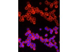 Immunofluorescence analysis of THP-1 cells using SHIP1 Rabbit pAb (ABIN3015068, ABIN3015069, ABIN6213623 and ABIN6213625) at dilution of 1:250 (40x lens). (INPP5D Antikörper  (AA 959-1188))