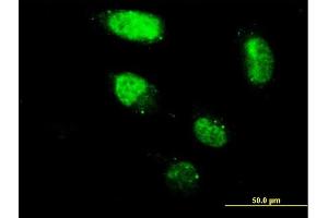 Immunofluorescence of monoclonal antibody to ZNF213 on HeLa cell. (ZNF213 Antikörper  (AA 133-242))
