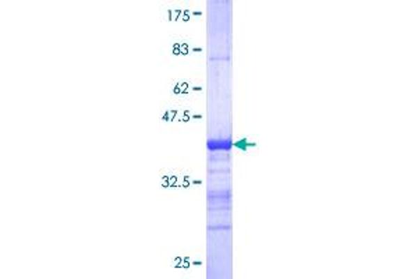 LIMK2 Protein (AA 152-252) (GST tag)