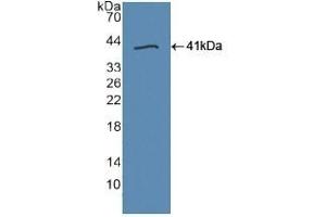 Detection of Recombinant TLR9, Human using Polyclonal Antibody to Toll Like Receptor 9 (TLR9) (TLR9 Antikörper  (AA 28-362))