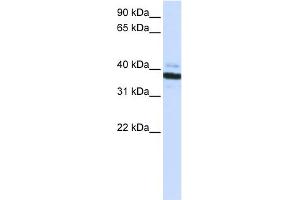 WB Suggested Anti-OAS1 Antibody Titration:  0. (OAS1 Antikörper  (C-Term))