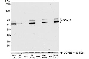 Western Blotting (WB) image for anti-SRY (Sex Determining Region Y)-Box 10 (SOX10) (AA 416-466) antibody (ABIN7455186)