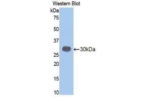 Western blot analysis of the recombinant protein. (Elastase 3B Antikörper  (AA 28-267))