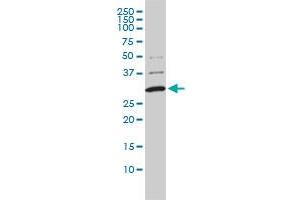 COMT monoclonal antibody (M01), clone 1G4-1A1 Western Blot analysis of COMT expression in A-431 . (COMT Antikörper  (AA 1-182))