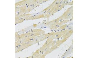 Immunohistochemistry of paraffin-embedded rat heart using TRAP1 Antibody (ABIN5971463) at dilution of 1/100 (40x lens).