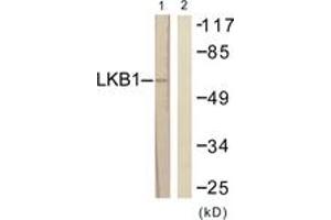 Western blot analysis of extracts from HeLa cells, treated with Serum 20% 15', using LKB1 (Ab-189) Antibody. (LKB1 Antikörper  (AA 155-204))