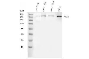 Western blot analysis of FASN using anti-FASN antibody (ABIN3044520).