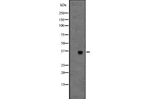 Western blot analysis of GPR3 expression in A431 whole cell lysate ,The lane on the left is treated with the antigen-specific peptide.
