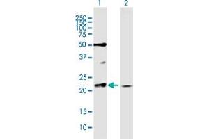 Western Blot analysis of RAB11A expression in transfected 293T cell line by RAB11A MaxPab polyclonal antibody. (RAB11A Antikörper  (AA 1-216))