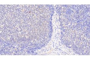 Detection of S100Z in Human Lymph node Tissue using Polyclonal Antibody to S100 Calcium Binding Protein Z (S100Z) (S100Z Antikörper  (AA 1-99))